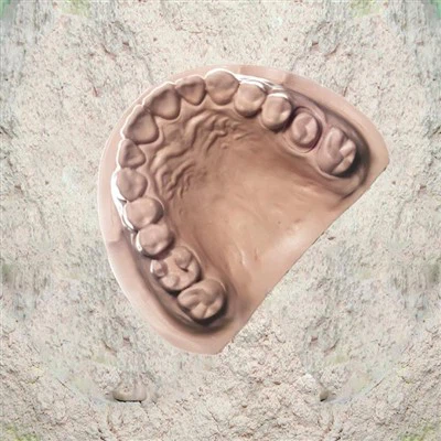 دانتوں کی جپسم کی قسم IV— ڈائی اسٹون